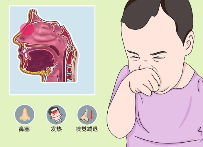 嬰兒鼻塞怎麼辦 嬰兒鼻塞怎麼辦