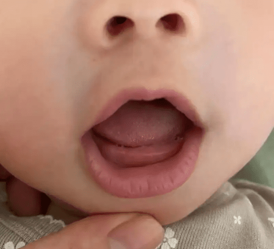 嬰兒 長 牙 嬰兒 長 牙