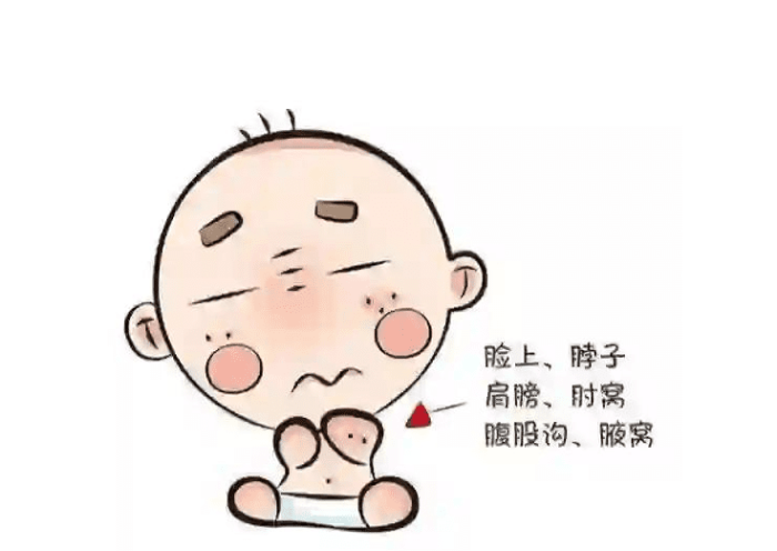 嬰兒熱疹 嬰兒熱疹