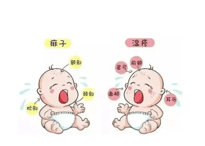 為什麼會長熱疹 為什麼會長熱疹
