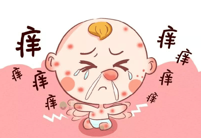 嬰兒過敏紅疹 嬰兒過敏紅疹