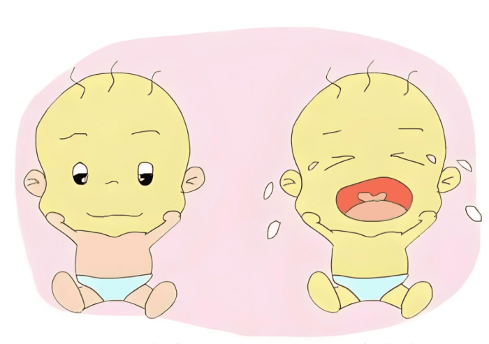新生兒黃疸 新生兒黃疸