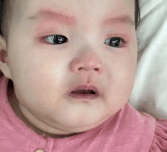 嬰兒腸絞痛原因